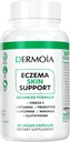 Eczema Συμπληρώματα - Formulated Dyshidrotic Eczema Pills for Adults - Providing Eczema Relief, Targeting the Intervention of Eczema, Irrited Dry Skin, and Enhanced with Psoriasis Supplements