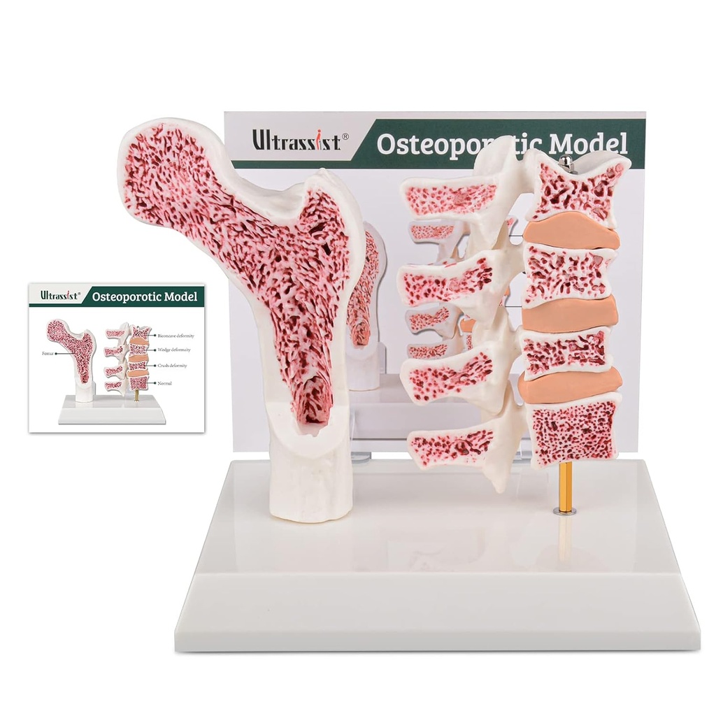 Ultrassist İnsan Anatomi Osteoporosis Modeli, Tıp Öğrenci Öğretimi için Çalışma Kartı ile Vertebrae Anatomik Skeleton Modeli