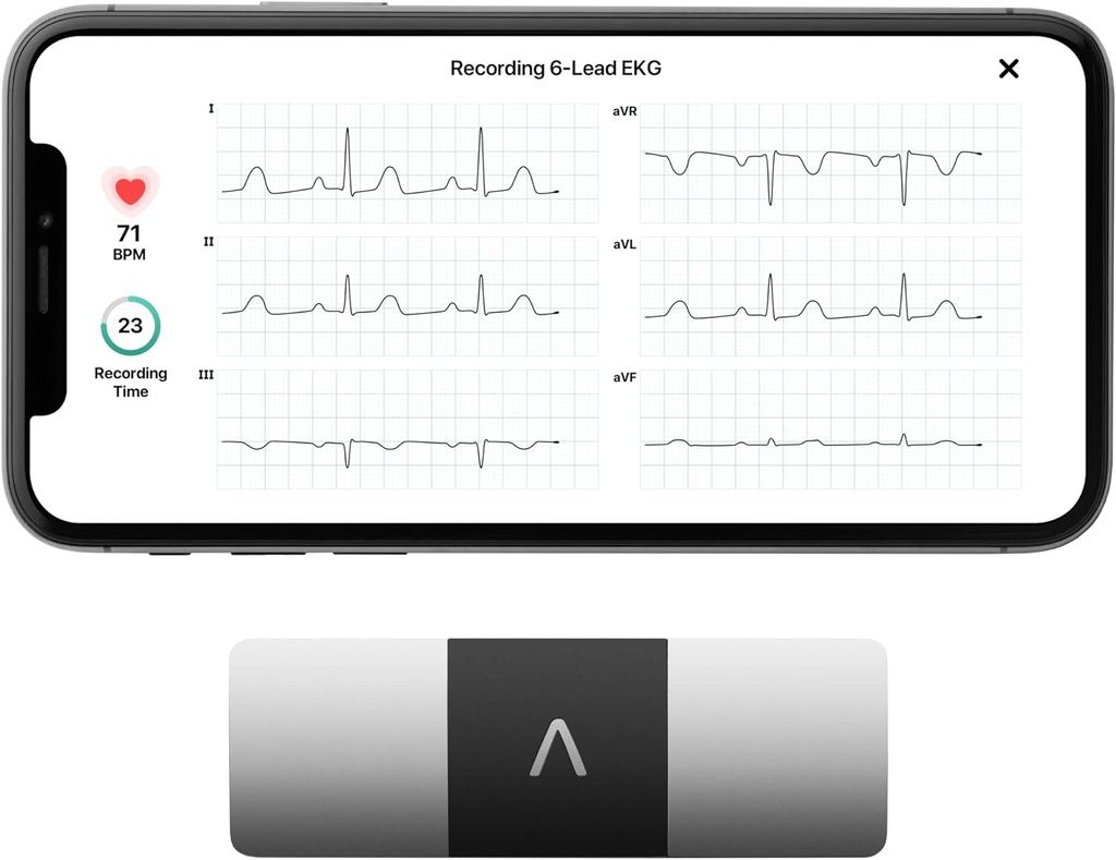 AliveCor KardiaMobile 6-Lead Personal EKG Monitor – Έξι Προβολές της Καρδιάς – Ανιχνεύει AFib και Ακανόνιστες Αρρυθμίες – Άμεση Αποτελέσματα σε 30 δευτερόλεπτα – Λειτουργεί με τα περισσότερα Smartphones