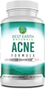 En İyi Dünya Naturals AcneSupplement Formula Blemish Blocker Clear, Radiant, Sağlıklı Skin + 30 Count'tan Blemishes