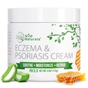 Wild Naturals Eczema & Psoriasis Krem için Kuru, Itchy Skin - Yetişkinler ve Çocuklar için Eczema Yardımı - Manuka Honey ile Psoriasis