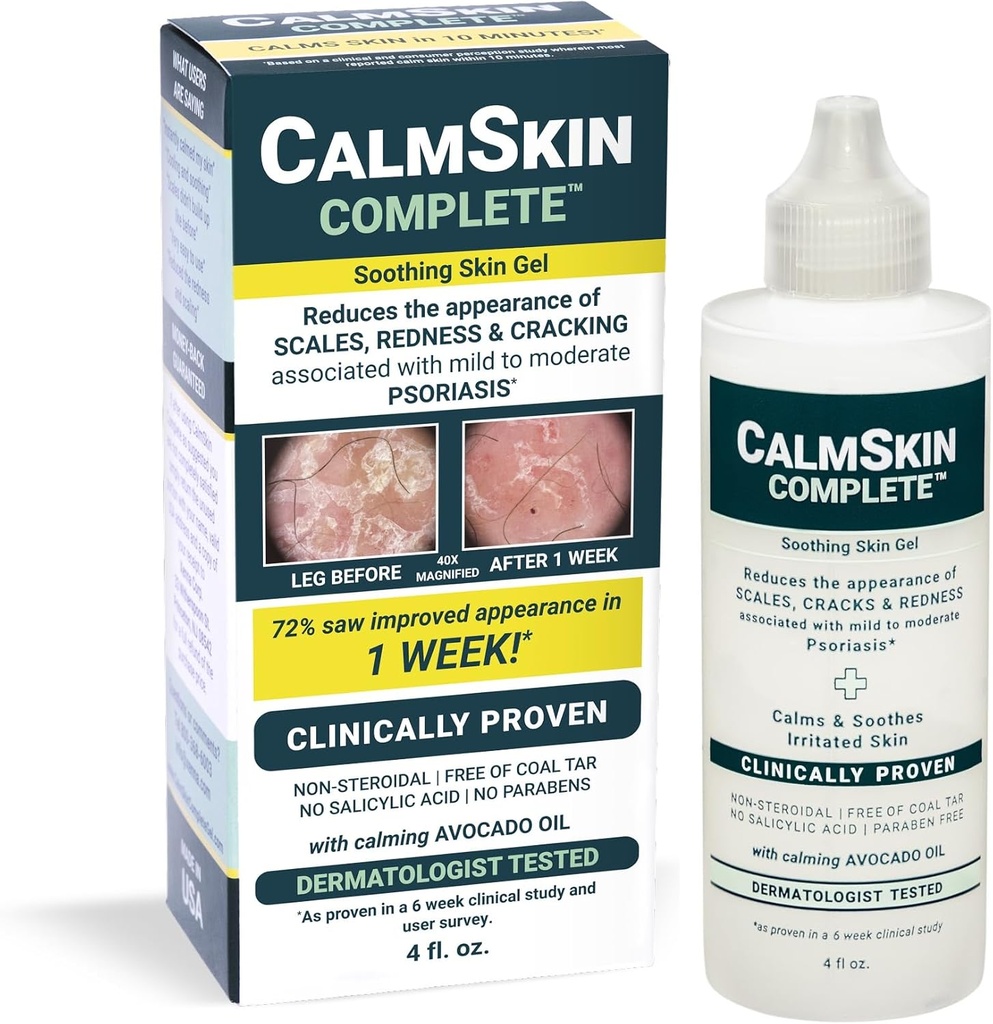 Xenna CalmSkin Tamam | Klinik Olarak Soothe Irritated Skin'e Proven ve Skin'in Görünümünü Mild ile Moderate Psoriasis | ABD'de Made in the USA | 4 fl. oz.