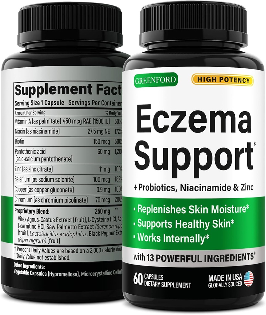 Greenford Eczema Tedavisi ve Doğal Yardıma Destek - ABD'de Yapılan - Eczema için Skin Vitaminler ve Herbals, Acne, Psoriasis, Rosacea Tedavisi, Çinko, Niacinamid & Probiyotikler - 60 kapak