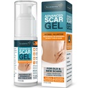 NUVADERMIS Σιλικόνη Scar Gel - 1.7 Fl Oz, Διαφανής Gel - Retinol & Βιταμίνη E Formula για Χειρουργικά Ουλές - C-Τομή, Tuck κοιλιά & Κελόιντ φροντίδα