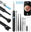 Loyker X6 Ear Wax Removal Tool Camera, Ear temizleyici with Camera, FSA - HSA Store Eable, 1080P Ear Camera with 6LED Light for Ear/Nose/Throat/Tonsil Stone Sınavı, Black