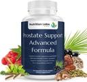 Prostate Health Herbal Supplement for Men with Beta Sitosterol, Selenium, Pygeum ve Superetto Prostate Support and Frequent Urination - 90 CT