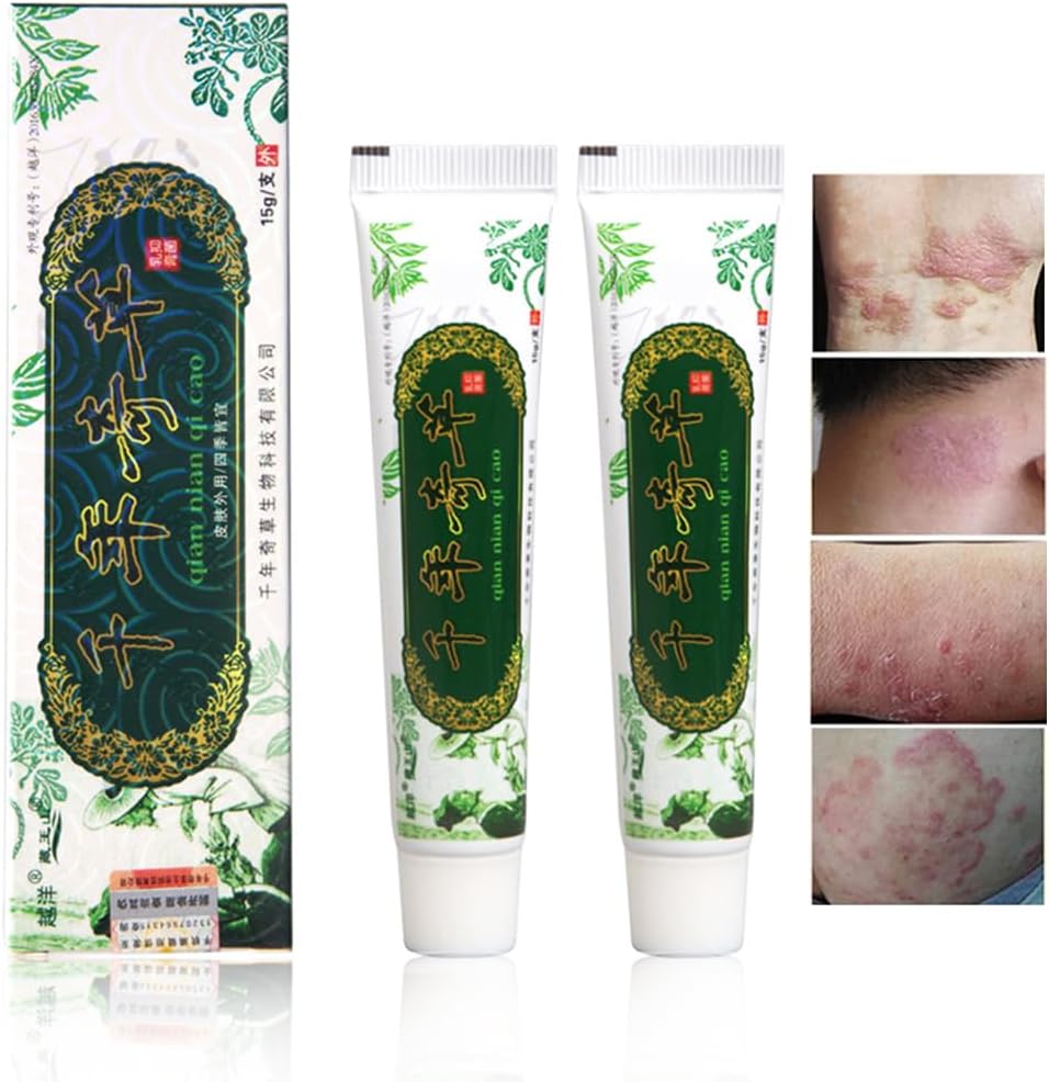 Oversea Thousand-Year Herbal Cream Chinese Herbal Eczema, Psoriasis Creams Dermatitis ve Eczema Pruritus Psoriasis JIULIN Ointment (2ücretli)