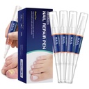 Nail Fungus Pen, Toenail & Fingernails için Toenail Fungus Pen Tedavisi, Fungal Nail Hasarı için Pen, Fungal Nail Onarımı