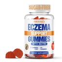 Sugar Free Eczema Tedavisi Gummies - ABD Made - 50+ Vitamins & Probiyotiks for Clear, Hydrated Skin - Soothes Itching, Calms Redness & Boosts Skin Health (60 Gummies)