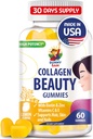 SUNNY SAM Biotin Collagen Gummies για γυναίκες & κορίτσια - χαμηλή ζάχαρη 60 μασώμενη ομορφιά κολλαγόνους Gummies για βελτιωμένο δέρμα μαλλιών και νύχια - Βιοτίνη, βιταμίνη Α, συμπλήρωμα ψευδαργύρου - φυσικό άρωμα λεμόνι