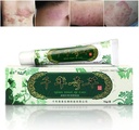 Oversea Thousand-Year Herbal Cream Chinese Herbal Eczema, Psoriasis Creams Dermatitis ve Eczema Pruritus Psoriasis JIULIN Ointment