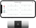 AliveCor KardiaMobile 6Lead Personal EKG Monitor – The Heart'ın Altı Görüşü – AFib ve Irregular Arrhythmias – 30 Saniyede Anında Sonuçlar – Çoğu Akıllı telefonlarla Çalışın